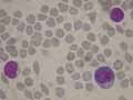 lymphoplasmocyte