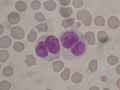 lympocytes bi-nucléés