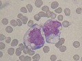 monocytes activés
