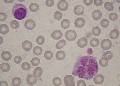 monocyte folié