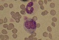 monocyte binucléé